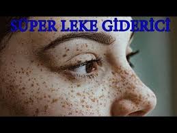Dogum Lekesi Gunes Lekesi Cilleri Yok Eden Dogal Maske Tarifi Guzellik Bakim Youtube Cilt Rengi Cil Cilt Bakimi