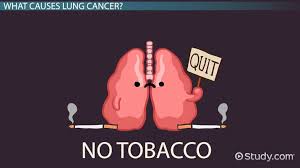 The most common cause of lung cancer is tobacco smoking. Lung Cancer Lesson For Kids Video Lesson Transcript Study Com