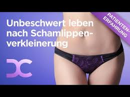 Weitere mögliche gründe für große schamlippen sind Schamlippenverkleinerung Dorow Clinic An Der Schweizer Grenze