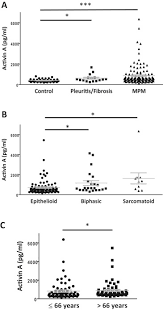Check spelling or type a new query. Circulating Activin A Is A Novel Prognostic Biomarker In Malignant Pleural Mesothelioma A Multi Institutional Study European Journal Of Cancer