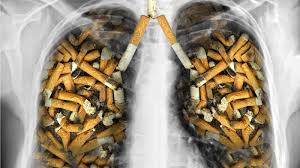 84% of lung cancer deaths and 83% of chronic obstructive pulmonary disease deaths are caused by smoking. How To Beat Smoking Ill Effects Luke Coutinho
