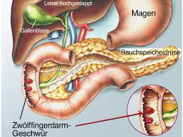 Rechte Seite Stechen Rippe Mogliche Ursachen Fur Rechtsseitige Bauchschmerzen Besser Gesund Leben 2019 11 05