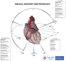 Mi Localization Litfl Medical Blog Ecg Anatomy Basics