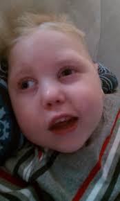Carson Bowman Menkes Disease Story: 2010