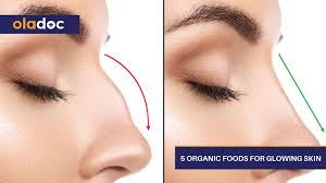The thin wall between the nostrils is made of cartilage and bone and is called the septum. Deviated Nasal Septum What To Do About A Crooked Nose Ent Ear Nose Throat Oladoc Com