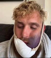 First thing that comes to mind