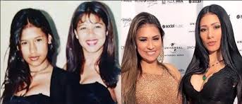 Além de michel teló e carlinhos brown, gaby amarantos integrará o time de técnicos da nova temporada do 'the voice kids'; 57 Ideias De Antes E Depois Rinoplastia Cirurgia Plastica De Celebridade Cirurgia Plastica
