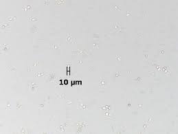 Giardia Cysts 10x Objective Zinc Sulphate Flotation From A Dog Medical Laboratory Scientist Medical Laboratory Veterinary