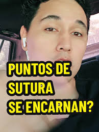 Respuesta a @dianufb19 SUTURA PUNTOS ENCARNADOS. #Sutura #encarnada los  puntos de sutura se encarnan? AGENDA CITA