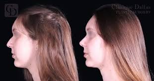 Clinique Dallas Plastic Surgery