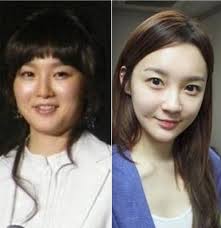 Kpop Celebrities That Went From Looking Flab To Fab