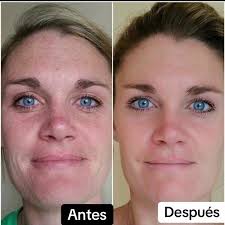 Mulher com pele jovem e luminosa 4