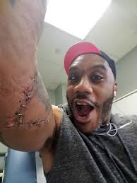 Fundraiser for Fabian Malone by Jessica Alexandra Gitlin : Fabian Malone  was Shot!