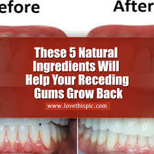 This can cause persistent bad breath (halitosis) and bleeding gums, as well as gradually receding gums. These 5 Natural Ingredients Will Help Your Receding Gums Grow Back