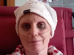 Raccolti altri 13mila euro per Daniela Molinari, 49enne malata di un tumore  raro: "Grazie di cuore"