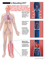 Medical Exhibits Demonstrative Aids Illustrations And Models