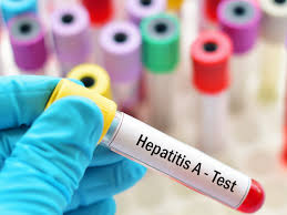 Il virus dell'epatite b (hbv) appartiene alla famiglia degli hepadnaviridae, virus a dna dotati di envelope e prevalentemente epatotropi responsabili dell'insorgenza di patologie epatiche acute (epatite acuta, epatite fulminante), croniche (epatite cronica. Epatite A Che Cos E E Come Si Trasmette Paginemediche