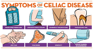 If you have celiac disease, you may experience digestive symptoms or symptoms in other parts of your body. Celiac Disease Symptoms Risk Factors Baptist Health Blog