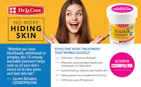 (1997) the treatment of rosacea: De La Cruz Sulfur Ointment Acne Medication Maximum Strength 2 6 Oz 73 7 G