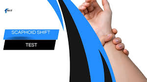 Image result for Scaphoid Shift Test