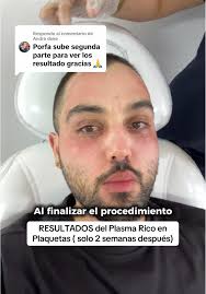 Respuesta a @André duke resultados Plasma Rico en Plaquetas: dos semanas y  ya la piel se ve mucho mas hidratada, luminosa y muchas lineas de expresion  & manchas se han disminuido🎖️ #plasma ...
