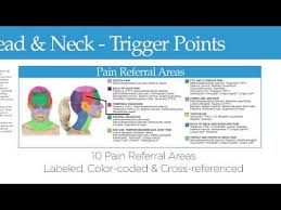 Pain Referral Areas Headache And Neck Trigger Point Chart