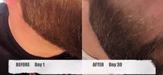 These antioxidants that can eliminate or reduce free radicals in the hair, allowing it to grow smoother and longer. My Gray Hair Reversal Update Life Vitality Gray Hair Rescind Lola S Life Lessons