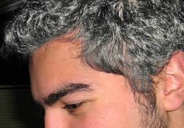 أسباب شيب الرأس وطرق علاجه