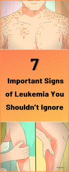 Pin On Chronic Leukemia