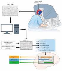 Brain Sciences | Free Full-Text | Association between Functional Brain  Network Metrics and Surgeon Performance and Distraction in the Operating  Room