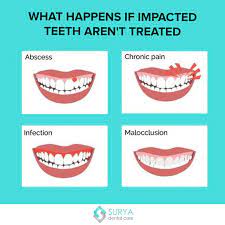 Pin On Modern Dental Surgery