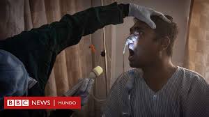 Se trata de la mucormicosis, también conocida como el hongo negro, una peligrosa pero rara infección causada por un hongo que ennegrece los tejidos y que ha encendido las alarmas. Hongo Negro 6 Preguntas Clave Sobre La Rara Infeccion Fungica Que Ataca A Pacientes De Covid 19 En India Bbc News Mundo