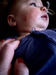 Benefits of RCM Rice bran Oil (Health Guard Oil)