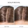 When you build up on your hair it can be very difficult to style it and can often have an appearance of being dull and dirty even when you've just there are numerous shampoos on the market that have been designed specifically to remove buildup from your hair. 3