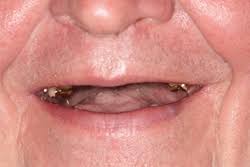 [Image: images?q=tbn:ANd9GcQsp8PzQkxeRMUTr5mT44a...JcAQ9LKYuQ]