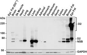 Eset protect advanced (eset remote workforce offer) full security for endpoints, mobiles, remote workforce, file servers and virtual machines license key: Abcd2 Is Abundant In Adipose Tissue And Opposes The Accumulation Of Dietary Erucic Acid C22 1 In Fat S Journal Of Lipid Research