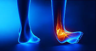 Image result for Leg Pain