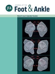 Quiero comprar barato más información. Medium Term Results Of The Hintegra Total Ankle Arthroplasty Journal Of The Foot Ankle