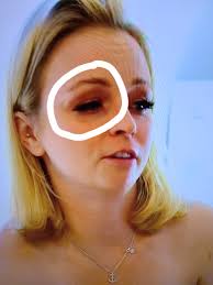 Is Lindsay's black eye terrible makeup?