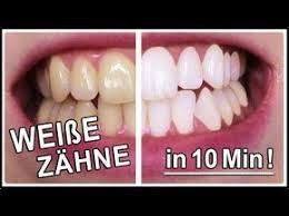 Weisse Zahne In 10 Minuten Gelbe Zahne Aufhellen Mit Diesen Hausmittel Weisse Zahne Wunscht Sich Ja Jeder Und Diesmal Habe Ich F Gelbe Zahne Zahnbelag Entfernen