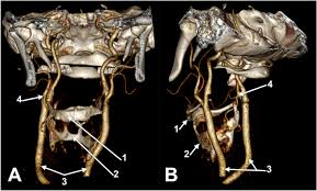 Image result for Hyoid Bone