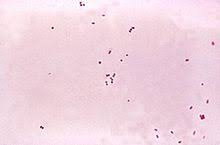 La meningite è l'infiammazione delle membrane che rivestono e proteggono l'encefalo e il midollo da quel momento in poi, il numero di casi di meningite associata a morbillo, rosolia o parotite ha in italia, per tutti i nuovi nati, sono disponibili alcuni vaccini che prevengono determinate forme di. Epidemiologia Della Meningite In Italia Wikipedia