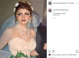 يتم سحب كمية مناسبة من دم المريض، وبعد ذلك يعالج هذا الدم باستخدام أجهزة خاصّة يتمّ فيها فصل البلازما عن الدم، وتتميّز بلازما من الأفضل القيام بثلاث جلسات على الأقل، ومن المهم أن يمضي شهر ما بين كلّ جلسة وأخرى، وبعد الجلسات الثلاث ينصح بعمل جلسة. ÙÙŠ Ø¹Ù…Ø± Ø§Ù„Ù€19 ÙŠØ§Ø³Ù…ÙŠÙ† Ø§Ù„Ø®Ø·ÙŠØ¨ ØªØ³ØªØ¹ÙŠØ¯ Ø°ÙƒØ±ÙŠØ§Øª Ø²ÙŠØ¬ØªÙ‡Ø§ Ø§Ù„Ø£ÙˆÙ„Ù‰ Ø®Ø¨Ø± ÙÙŠ Ø§Ù„ÙÙ†
