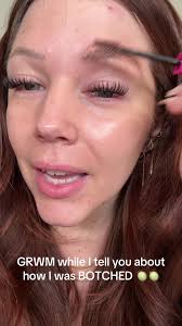 Dr Grunberg Botched Me San Antonio