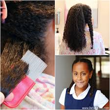 Most black boys get their hair cut, which helps with remedying the lice problem. Black People Can Get Lice How To Treat Lice When Your Have Curly Hair
