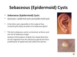 Https Www Google Com Search Q Fascial 20planes Tbm Isch Imgil Ii5 C1zvuqb4zm 253a 253blh9dk7xcwx0gim 253bhttps Epidermoid Cyst Cyst Sebaceous Sebaceous Gland