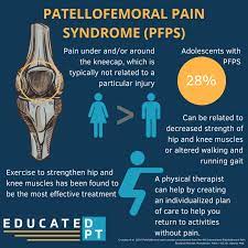 Patellofemoral Pain Syndrome A Quick Reference Educatedpt