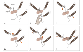 Threading a needle sounds simple enough but did you know that you're probably doing it wrong? Minimally Invasive Knot Tying A The Knot Typing Procedure Starts Download Scientific Diagram