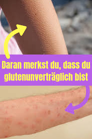 Bist Du Glutenintolerant Achte Auf Die Warnhinweise Deines Korpers Glutenfreie Rezepte Glutenfrei Backen Glutenfrei Rezepte Health Jesus Fish Tattoo Jesus
