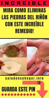 Mira Como Eliminas Las Piedras Del Rinon Con Este Increible Remedio Remedies Natural Remedies Health